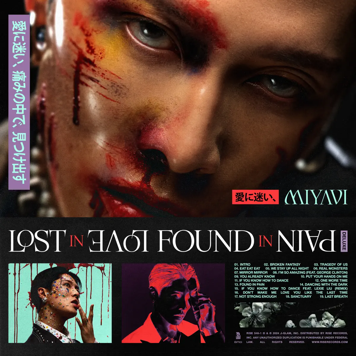 MIYAVI - LOST IN LOVE, FOUND IN PAIN (Deluxe) (2025) [iTunes Plus AAC M4A]-新房子