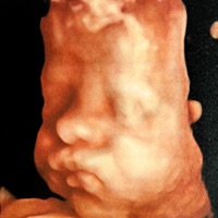 Ian Gael - Single - Ivan Espinal & Mayelyne Rodriguez