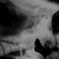 UNRULY (feat. Grafezzy & NixoRarri) - Single - imakebeats