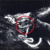 Lesotho - Single - vidhukota