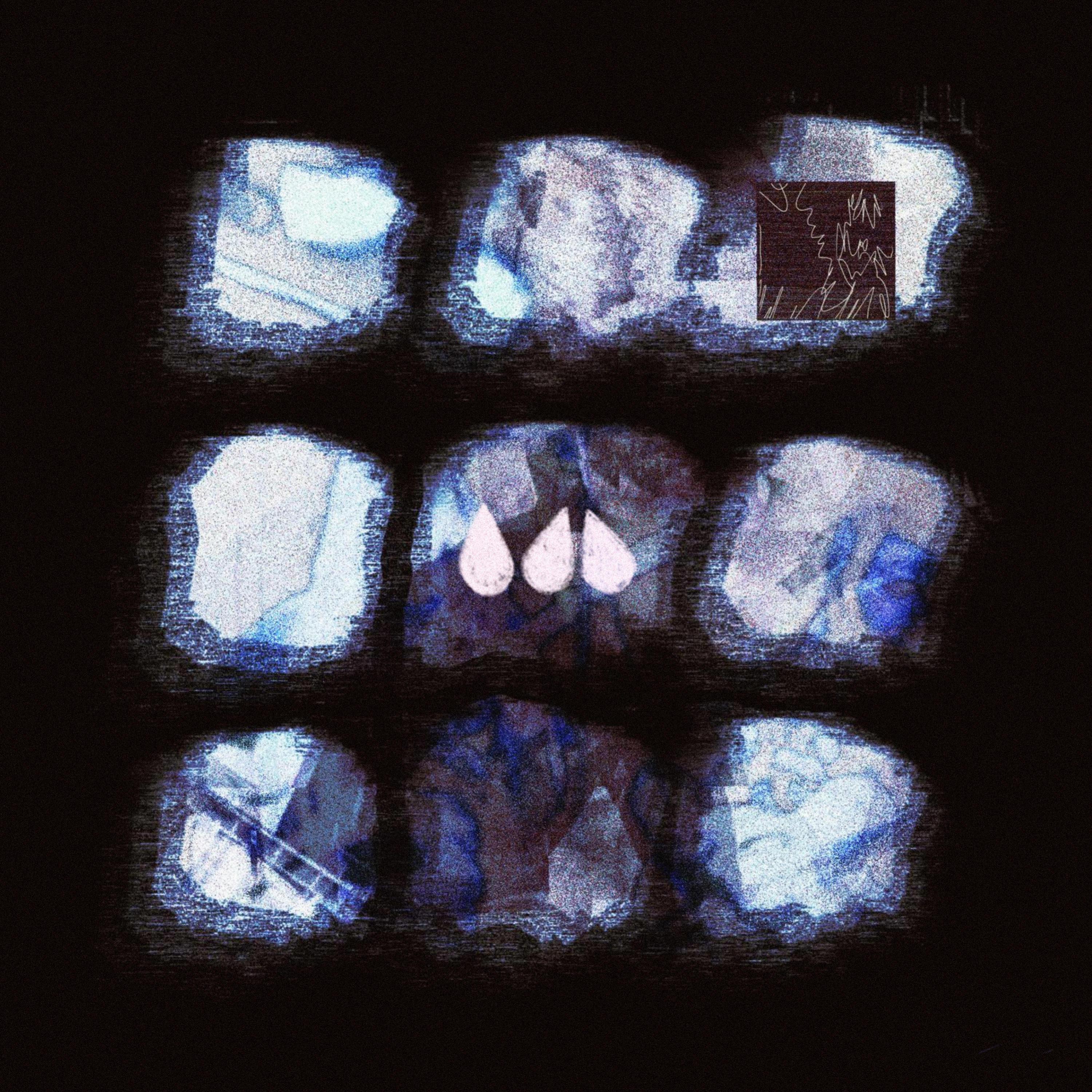 Tiles - EP