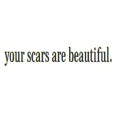 your scars are beautiful. - Single