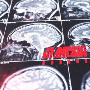 Amnesia