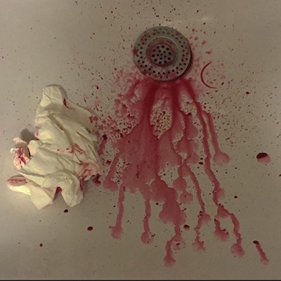 Wirbelsturm - Single