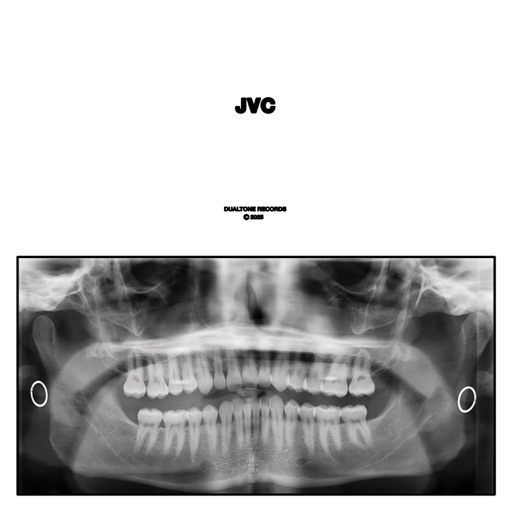 Album artwork