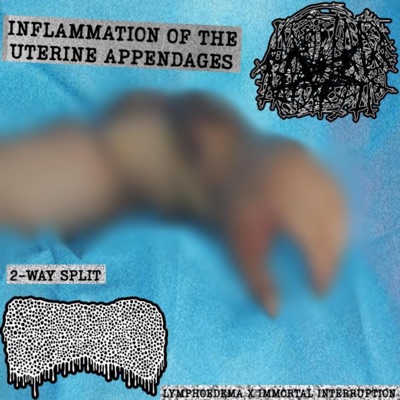 5 Stages Of Surgical Torture - Single