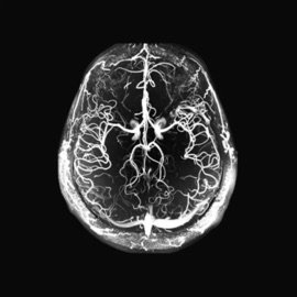 trojan horse (feat. MO$h) PIERIDXE