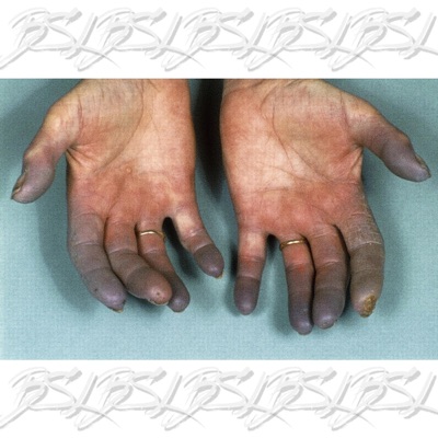 big smile lee vol. 2