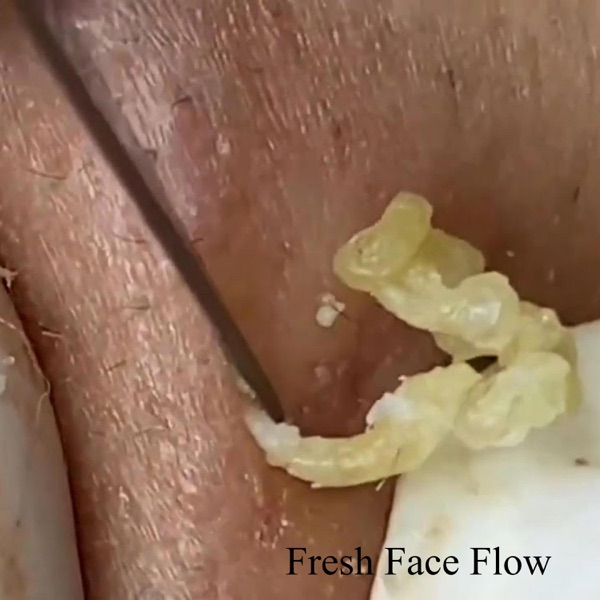 Fresh Face Flow - Single