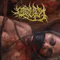 Rectal Fisting Through Mastectomy Procedure