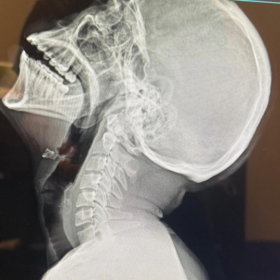 ROT (feat. BXXN) - Single