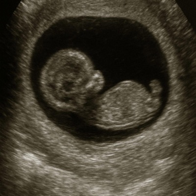 Get me pregnant - Single