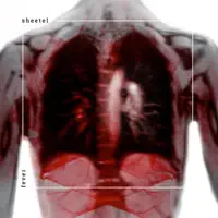 Fever — Sheetel