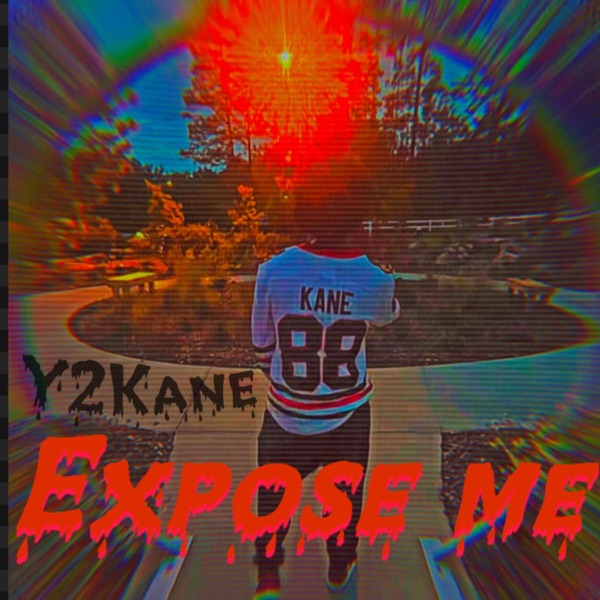 Expose Me