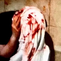 NAPE REMOVAL - Single - Griimcityreaper