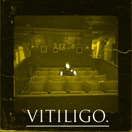 RA.turn (feat. Potter & JimBob Gnarly) VITILIGO.