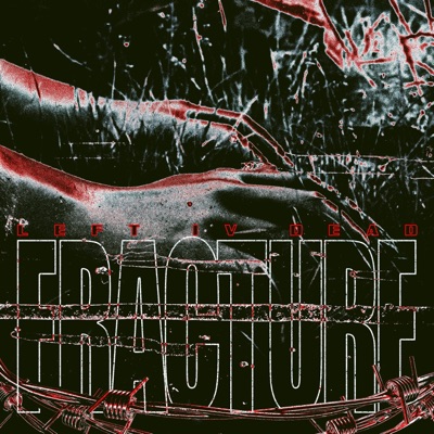 Fracture - Single