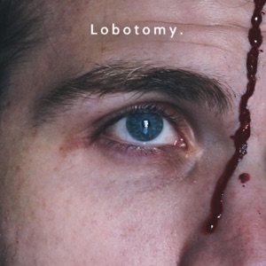 Lobotomy - Single