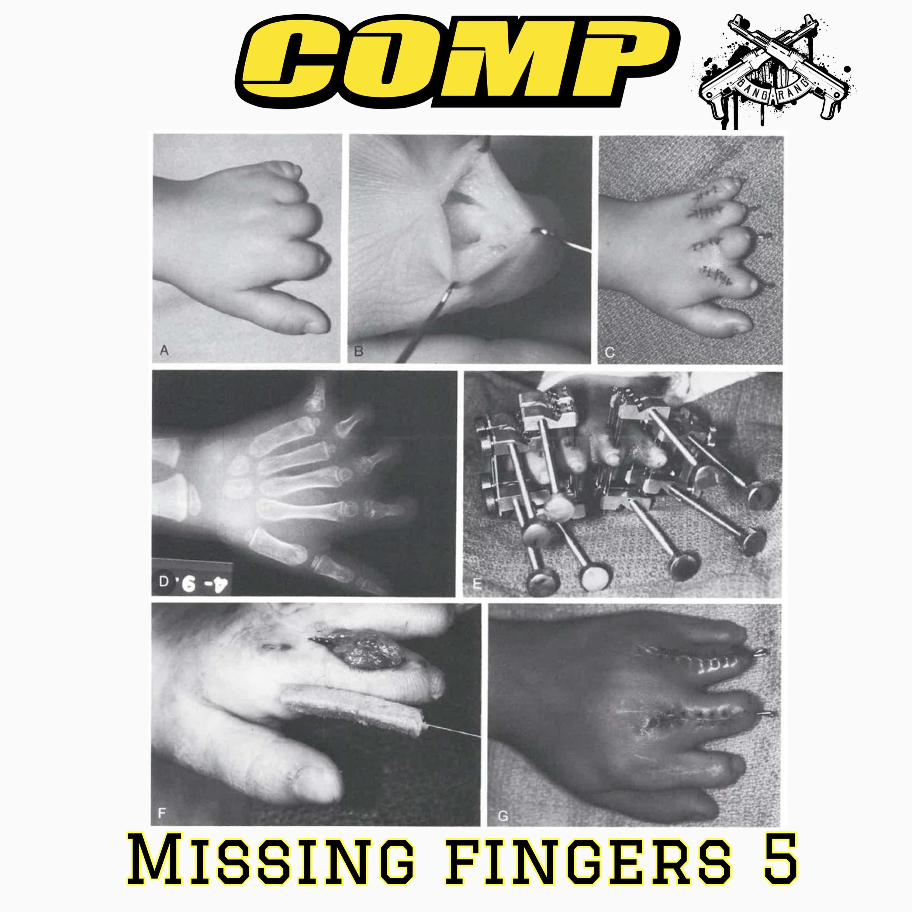 missing fingers 5