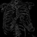 Hollow Cage