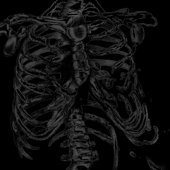 Hollow Cage