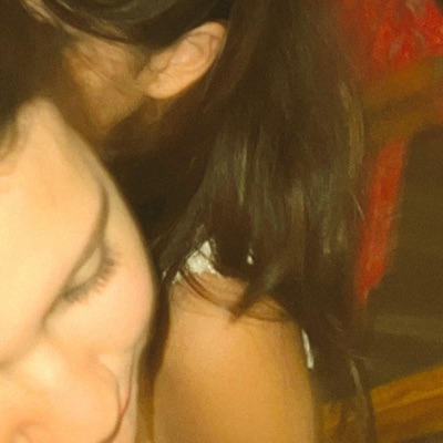 Hurts (Peter P Remix) - Single