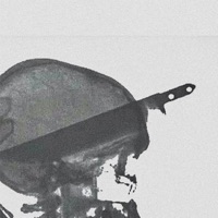 x-ray - Single - Psychosis