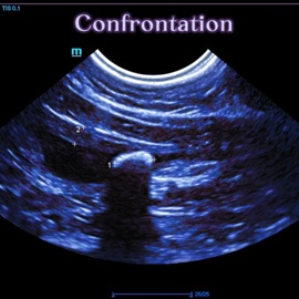 Разогнаться и биться НЗ
