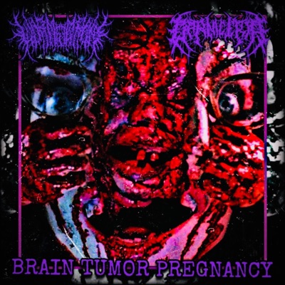 Brain Tumor Pregnancy (feat. Carniceria) - Single