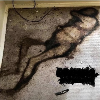 esophagomyotomy (feat. esophagus & abcess pool) [HQ] - Single