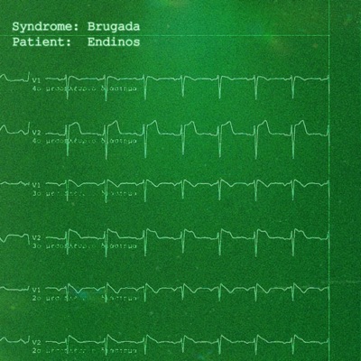 Brugada - Single