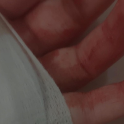 rotting girl - Single