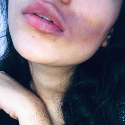 bruises (feat. lavendr & hauntingclaire) - Single