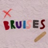 Bruises