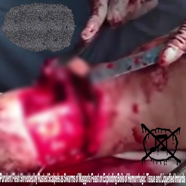 Cadaverous Sludge Gurgling Through Macinated Intestinal Pus Tunnels Marinated with Putrid Ear Fluid From Cracked Skull Fragments Into a Pool of Expired Vomit