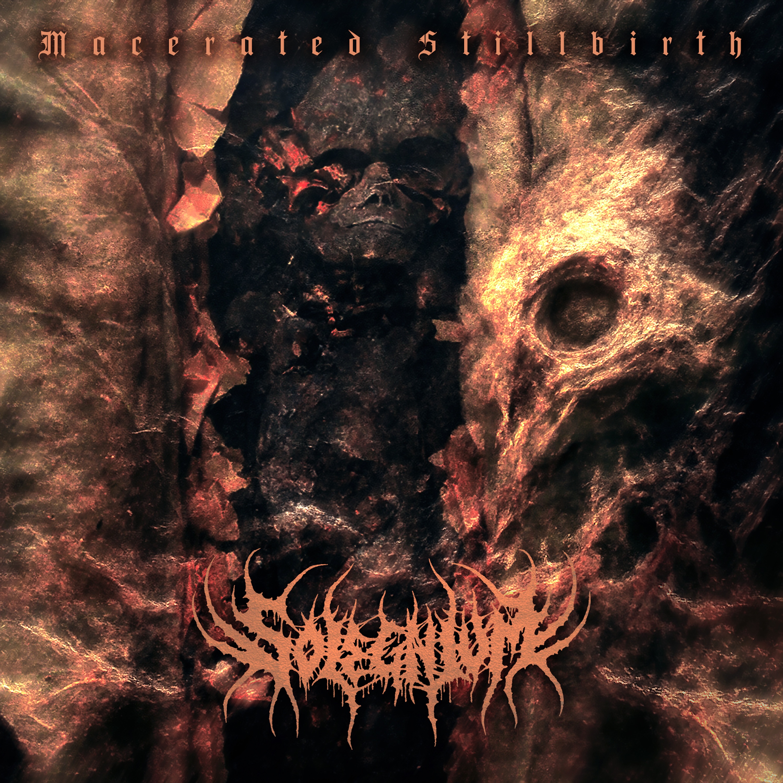 Solegnium - Macerated Stillbirth