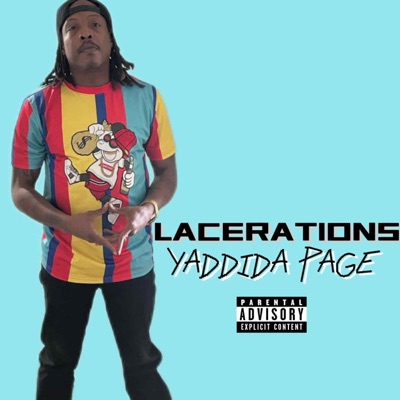 Lacerations - Single