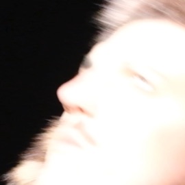 Моя больная голова КИСЛОТА