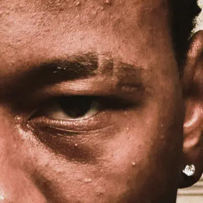 Hör dir „Lozer“ von 9dreamz an