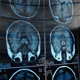 Moving Lonely 916frosty & Dancody