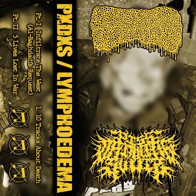 Split with Lymphoedema