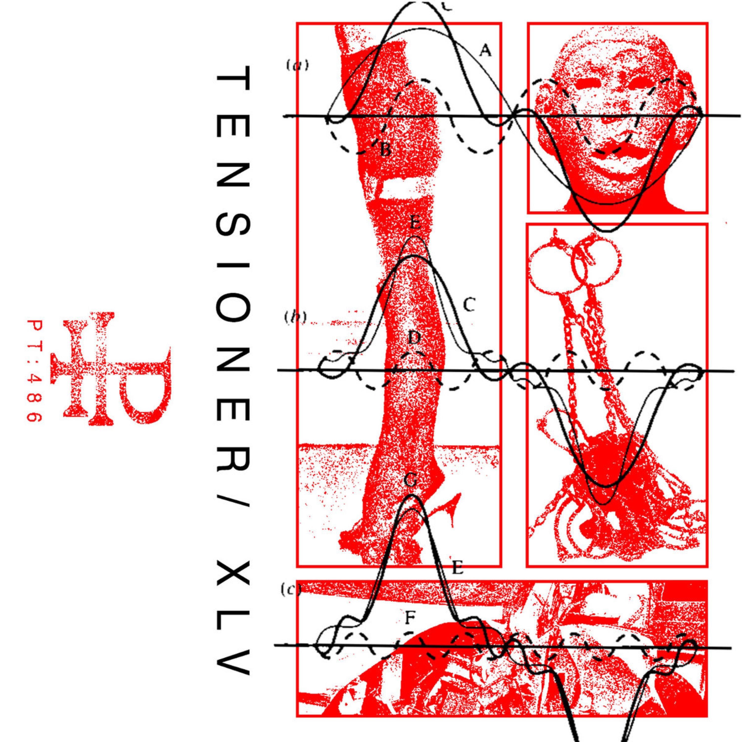 Tensioner / XLV - EP