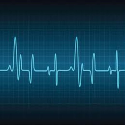 Apple Music Presents: LIL-ZOELLNER's "Heart rate", Vol. 1 (SNEAKPEAKS)