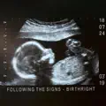 Birthright