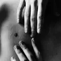 Inherited Scars