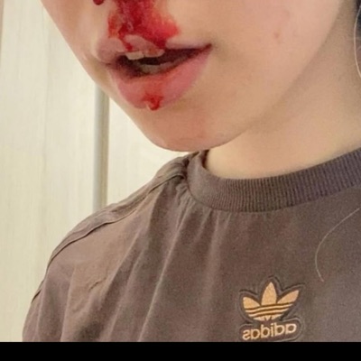 deadc0kewh0rexD (DJ KetSniff Remix) - Single