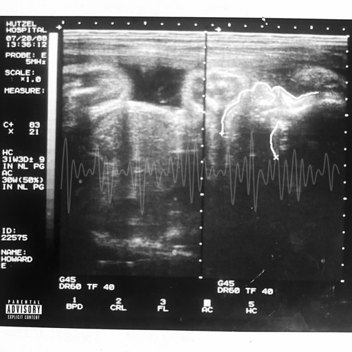 Album artwork
