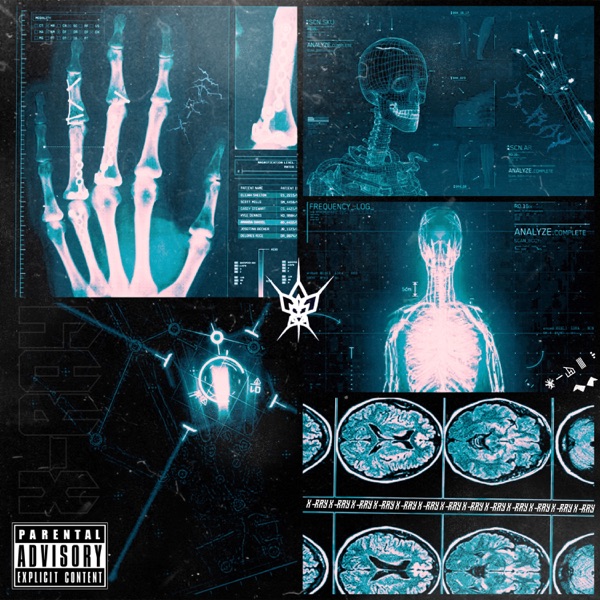 X-RAY (feat. OUTCAST BLOCK)
