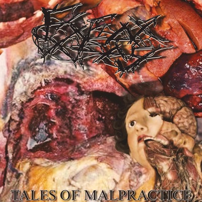 Tales of Malpractice