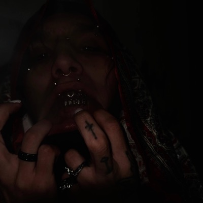 Chicken Pox - Single